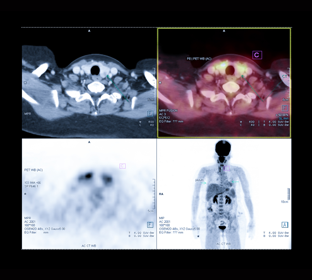 PET-CT Digitale diagnosi