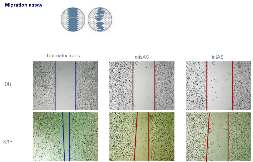 Migration assay - oligonucleotidi antisenso