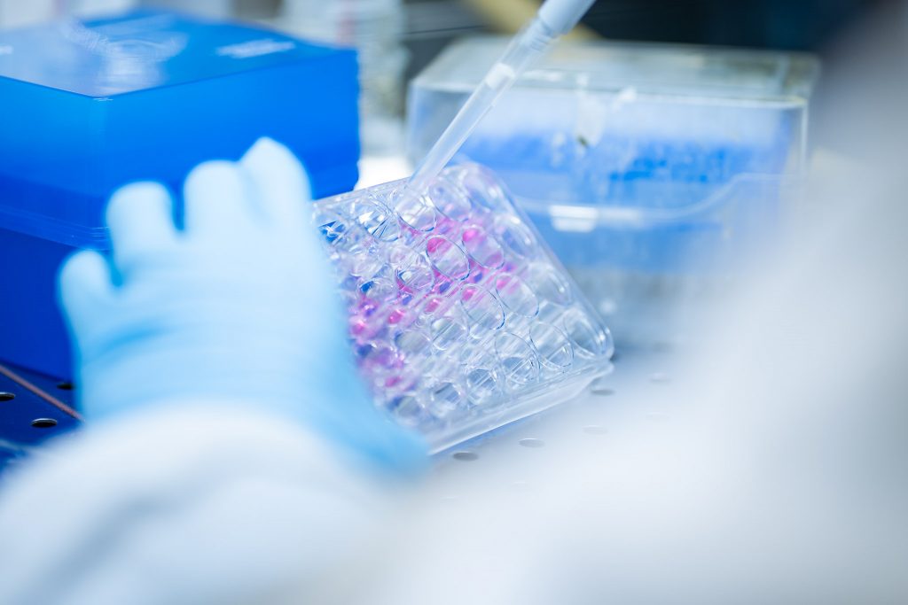 ricerca sulla resistenza ai tumori nel progetto IMCURE