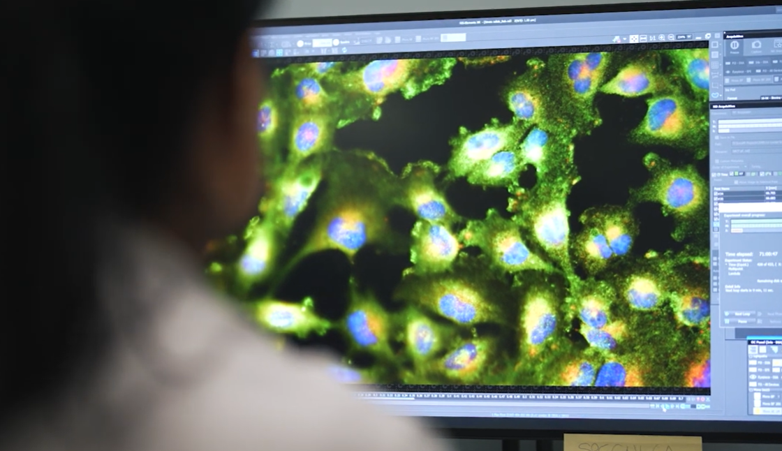 Le neoplasie mieloidi: uno spettro ampio di malattie diverse